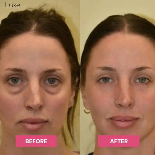 Luxe - Korean Under-Eye Balm Luxe Research